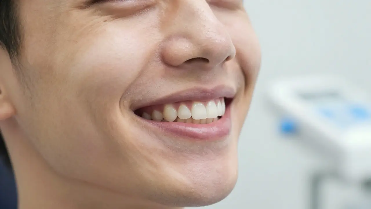Kdy sundat retainer? Kompletní průvodce po fixních rovnátkách