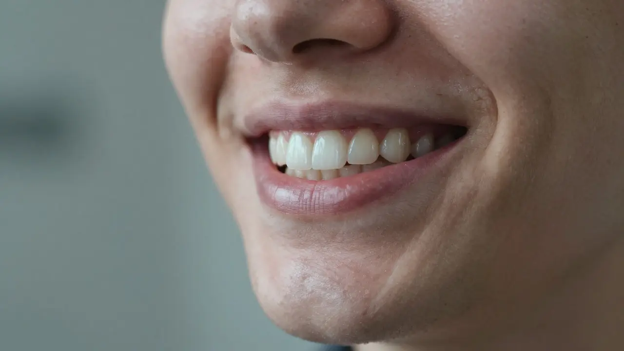 Jak vybělit zubní můstek: Skutečné možnosti a omyly